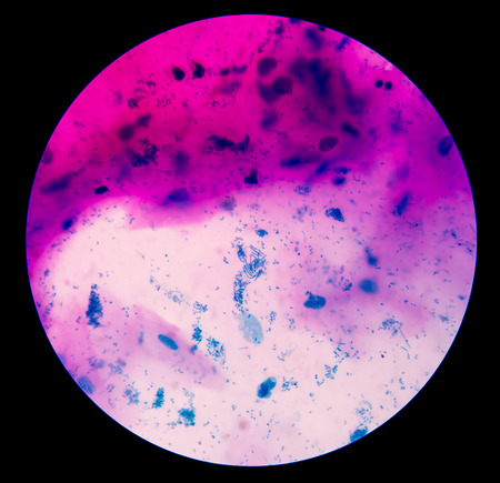Gram staining, also called Gram's method, is a method of differentiating bacterial species into two...