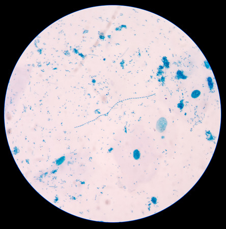 gram positive cocci in chain.