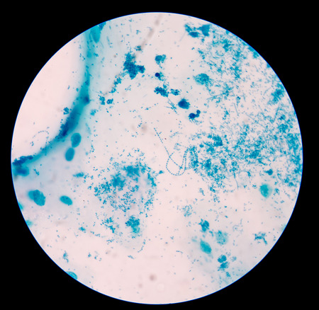 Gram staining, also called Gram's method, is a method of differentiating bacterial species into two...