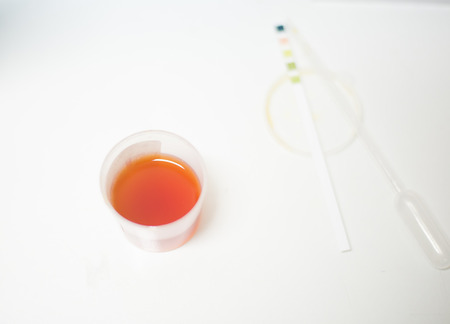 Blurred Medical urine test brown color.の写真素材
