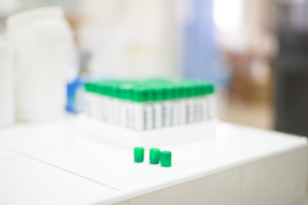 Blurred test tube in laboratory.