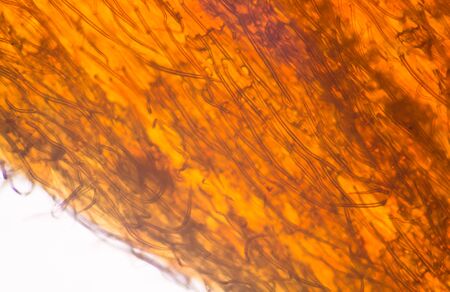 Plant cells of Bastard Teak, Bengal Kino, Flame of the Forest