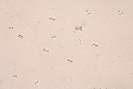 triple phosphate crystals in human urine fine with microscope.の写真素材