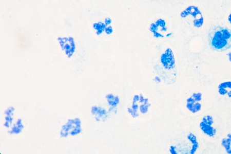 showing a blue white blood cell under microscope.