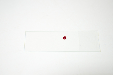blood drops on glass slideの写真素材
