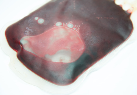 Blood bag Filled blood bag on white backgroundの写真素材