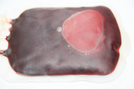 Blood bag Filled blood bag on white backgroundの写真素材