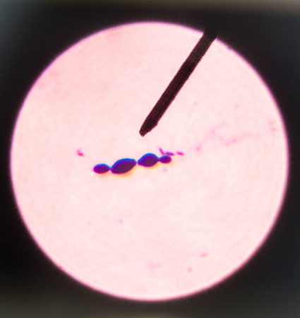 Budding yeast cells in sputum gram stain fine with Microscope 100x.