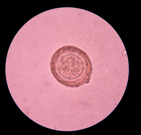 Hymenolepis diminuta parasite egg in stool exam.の写真素材