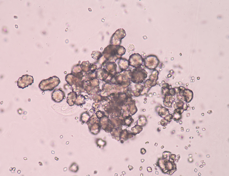 Uric acid crystal in urine sediment.
