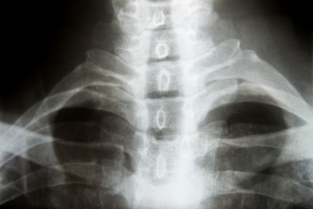 neck x-ray imageの写真素材
