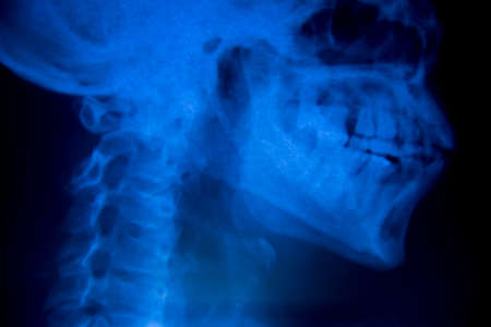 X-ray asian skull and blank area.の写真素材