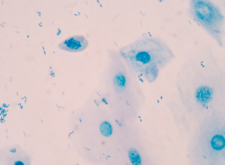 Blue bacteria in gram stain sputum.の写真素材