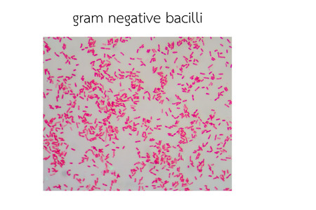 Gram staining, also called Gram's method, is a method of differentiating bacterial species into two large groups (Gram-positive and Gram-negative).の写真素材