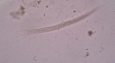 Strongyloides stercoralis is a human parasitic roundworm causing the disease strongyloidiasis.