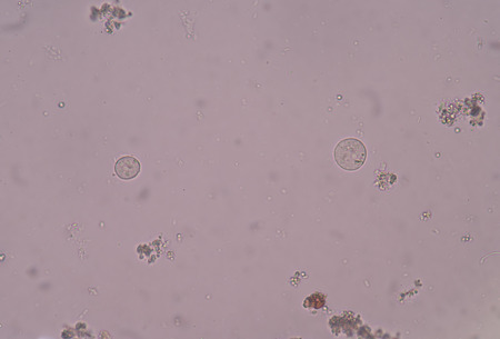 protozoa in stool exam.