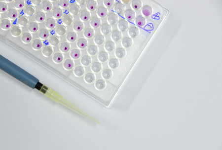 U plate with micro pipette laboratory equipment.