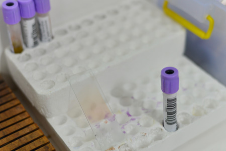 Blood test for Complete Blood Count. CBC medical science background concept.