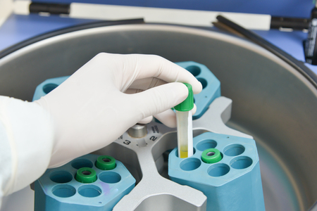 technician placing blood tubes in the laboratory centrifugeの写真素材