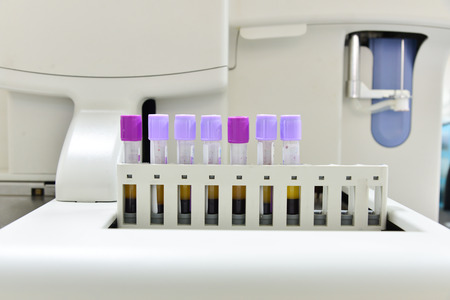 Automate analyzer complete blood count in laboratory.の写真素材