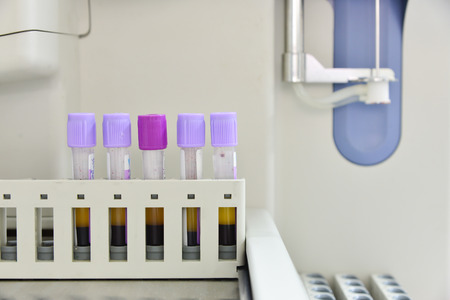 Automate analyzer complete blood count in laboratory.の写真素材