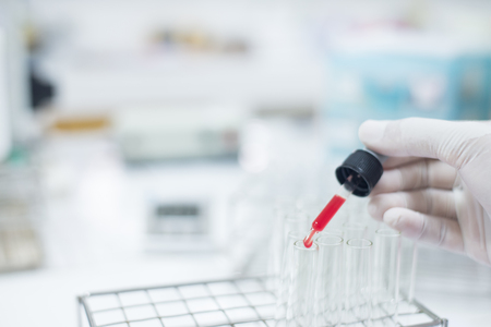 scientist with equipment and science experiments ,Laboratory glassware containing chemical liquid, science research,science background.の写真素材
