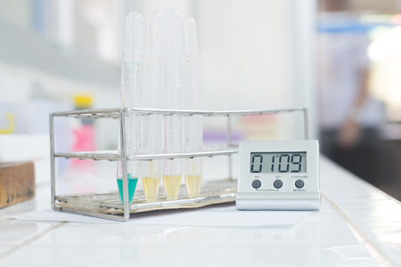Lab Urine analyzer yellow and blue urine. Scientific research background.