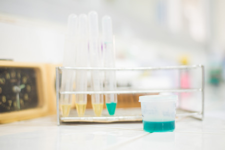 Blue urine complication of drug and normal yellow urine in laboratory testing.