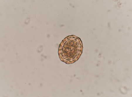 Egg of Parasitic nematode worm (roundworm) Ascaris lumbricoides which inhabits human intestine and causes disease ascariasisの写真素材