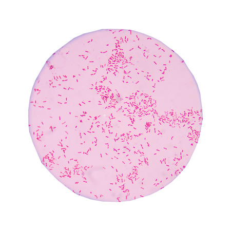 red gram negative bacilli on white background.の写真素材