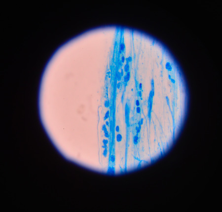Blue Branching budding yeast cells with pseudohyphae in urine gram stain fine with microscope.の写真素材
