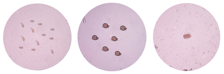 Eggs of parasite in stool exam human