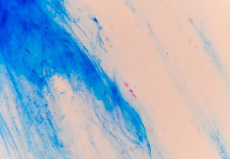 Moderate red cells mycobacterium tuberculosis on blue background.