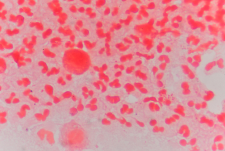 Gram staining, also called Gram's method, is a method of differentiating bacterial species into two...