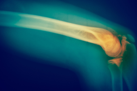 Close up  bone  x-ray medical science backgroundの写真素材