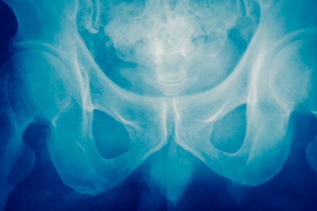 Close up bone  x-ray medical science backgroundの写真素材