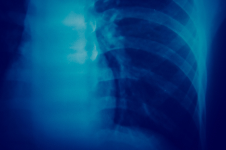 Close up bone  x-ray medical science backgroundの写真素材
