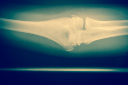 Close up bone  x-ray medical science backgroundの写真素材