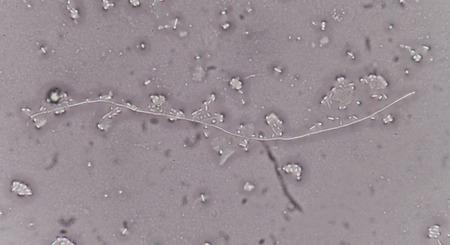 Yeast cells in urine specimensMedical science background.