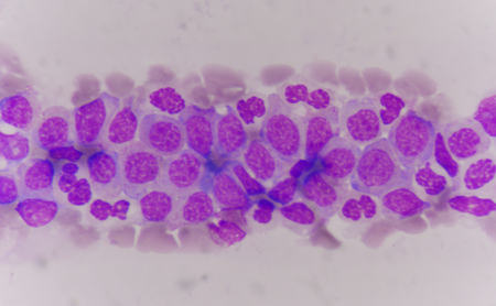 Normail and abnormal cells Medical science background concept.