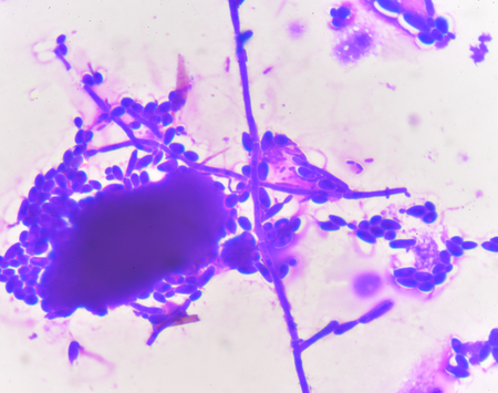 Budding yeast cells with pseudohyphae Gram stain method
