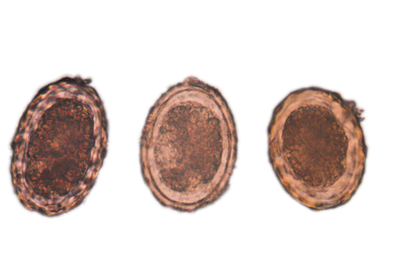 ascaris egga