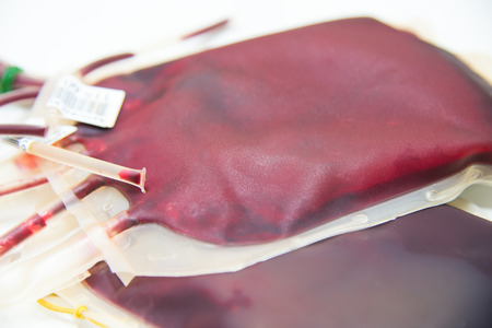 red blood bag in labの写真素材