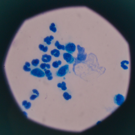 blood cells with microscope.の写真素材