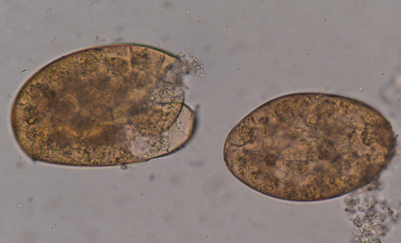 Eggs of parasite with microscope.