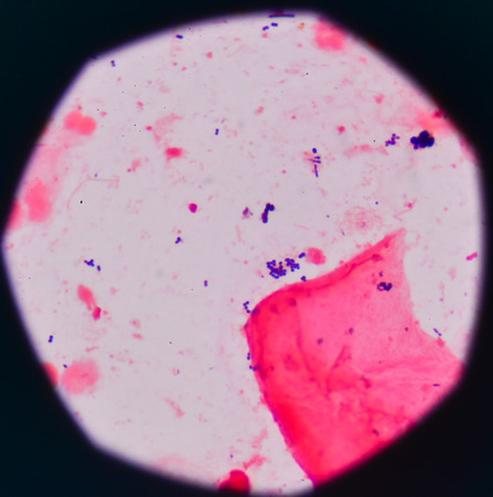 Blue bacteria cells on red background Gram stain method.