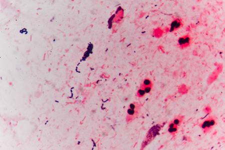 Bacteria cells Gram positive cocci in chain medical background.の写真素材