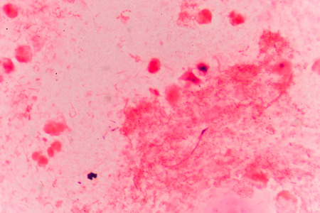 Bacteria cells Gram positive cocci in chain medical background.の写真素材
