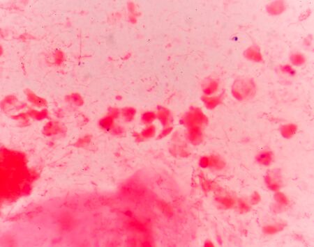 Bacteria cells Gram positive cocci in chain medical background.の写真素材