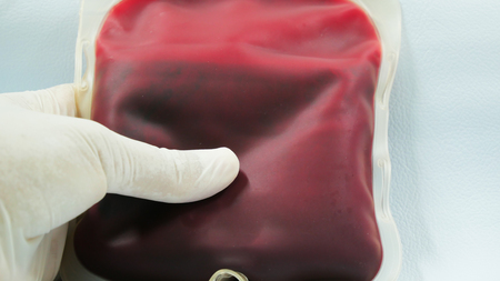 Close up on red blood bag in laboratory.の写真素材